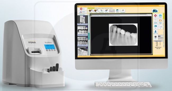 Сканер в стоматологии для чего